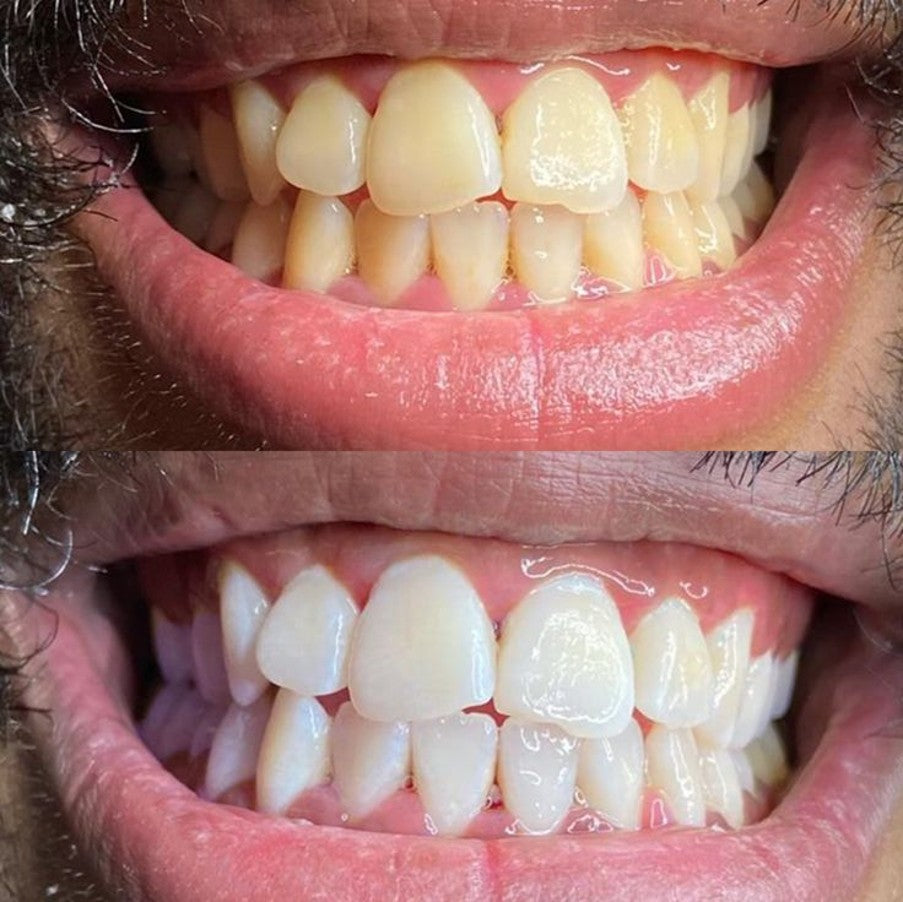 WHITE SMILE™ — Dentifrice Éclat & Blancheur By DR. WIKEY