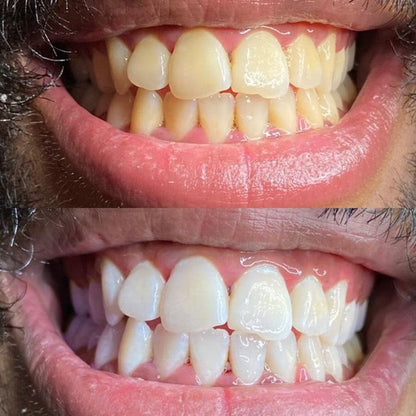 WHITE SMILE™ — Dentifrice Éclat & Blancheur By DR. WIKEY